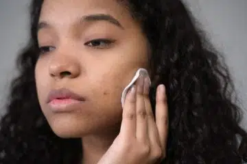 pores-peau-dilates